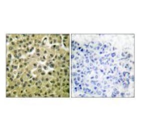 Immunohistochemistry - MCL1 Antibody from Signalway Antibody (33430) - Antibodies.com