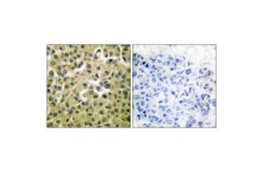 Immunohistochemistry - MCL1 Antibody from Signalway Antibody (33430) - Antibodies.com