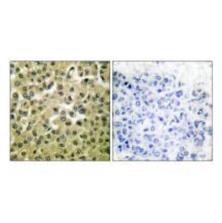 Immunohistochemistry - MCL1 Antibody from Signalway Antibody (33430) - Antibodies.com