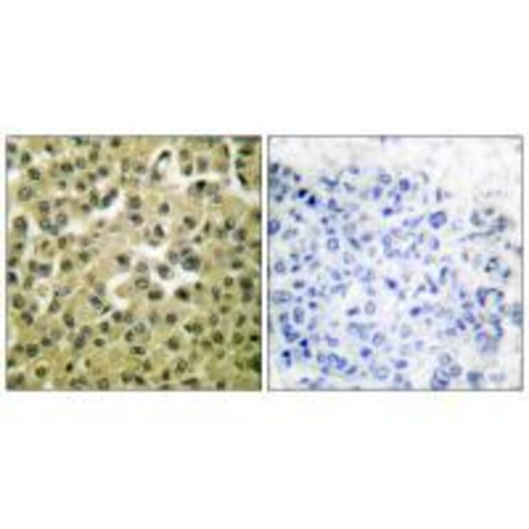 Immunohistochemistry - MCL1 Antibody from Signalway Antibody (33430) - Antibodies.com