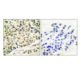 Immunohistochemistry - MCM2 Antibody from Signalway Antibody (33431) - Antibodies.com