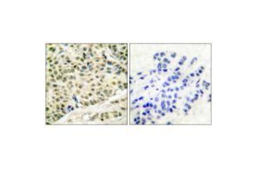 Immunohistochemistry - MCM2 Antibody from Signalway Antibody (33431) - Antibodies.com