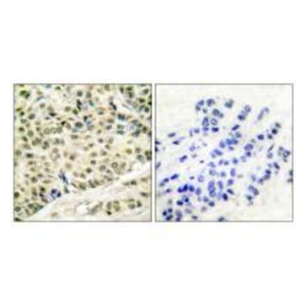 Immunohistochemistry - MCM2 Antibody from Signalway Antibody (33431) - Antibodies.com