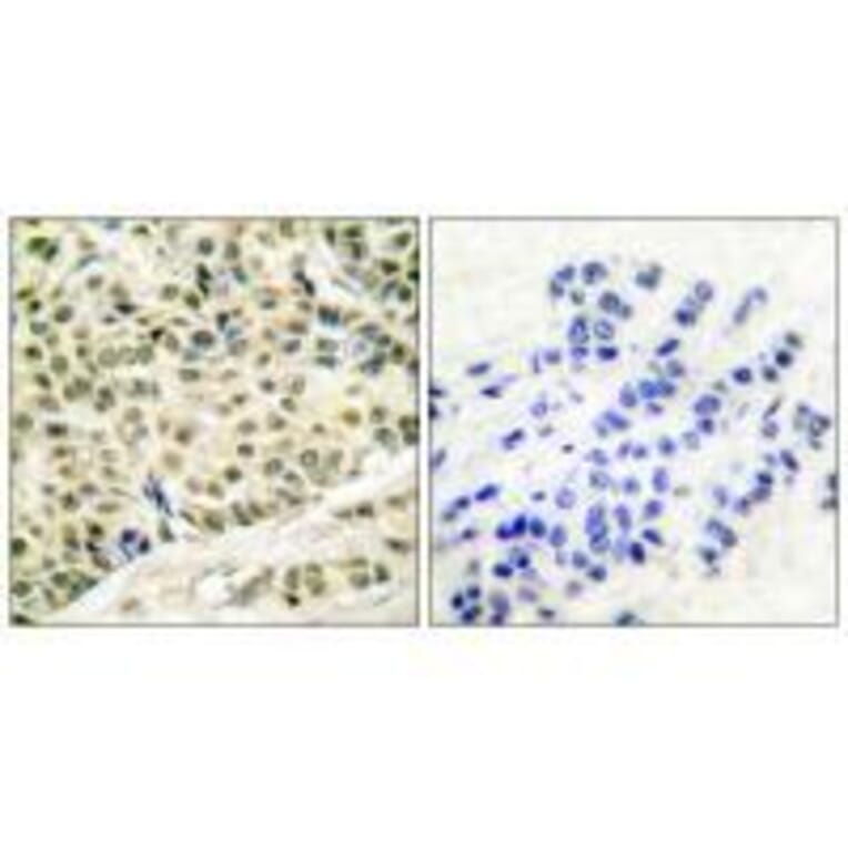 Immunohistochemistry - MCM2 Antibody from Signalway Antibody (33431) - Antibodies.com