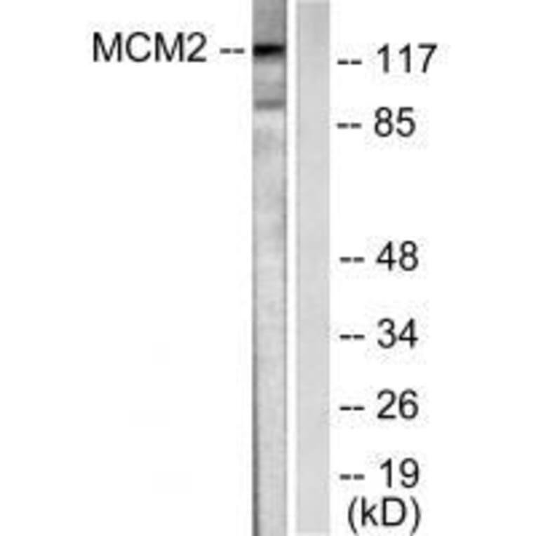 Western blot - MCM2 Antibody from Signalway Antibody (33431) - Antibodies.com