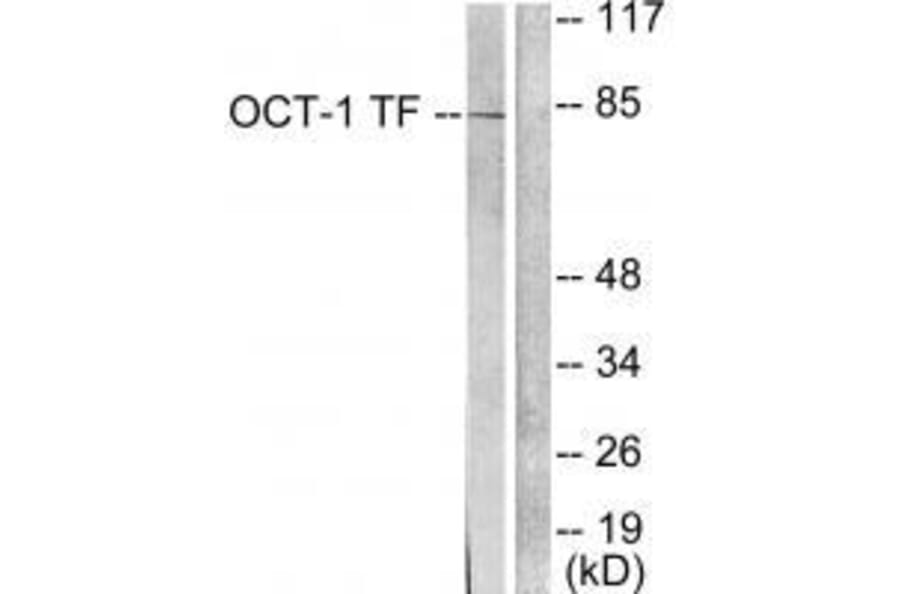 Western blot - OCT1 Antibody from Signalway Antibody (33452) - Antibodies.com