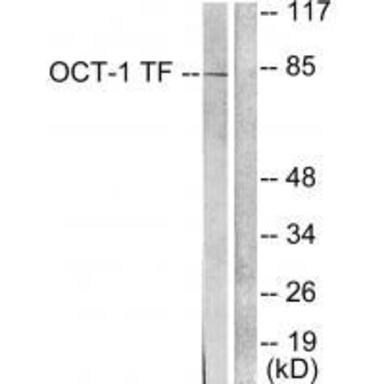 Western blot - OCT1 Antibody from Signalway Antibody (33452) - Antibodies.com