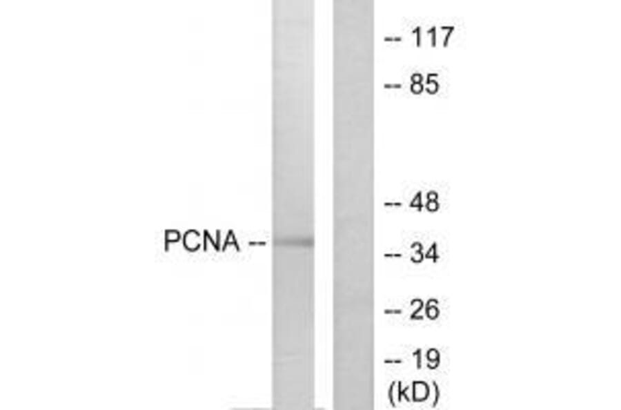 Western blot - PCNA Antibody from Signalway Antibody (33468) - Antibodies.com