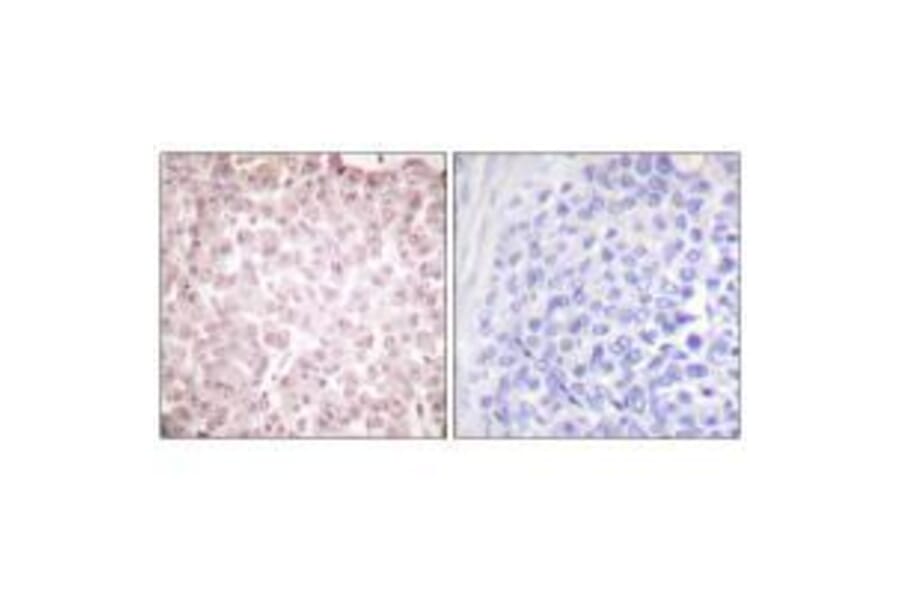 Immunohistochemistry - RCC1 Antibody from Signalway Antibody (33479) - Antibodies.com
