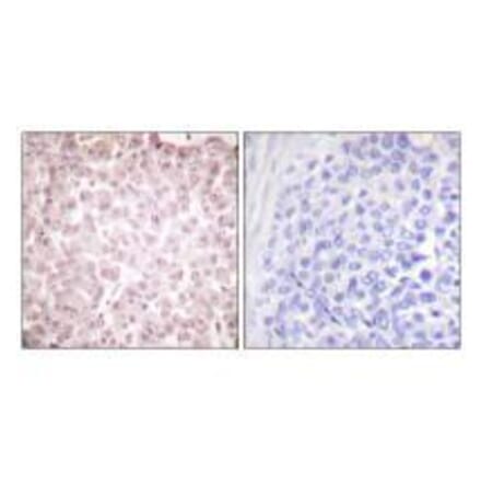 Immunohistochemistry - RCC1 Antibody from Signalway Antibody (33479) - Antibodies.com