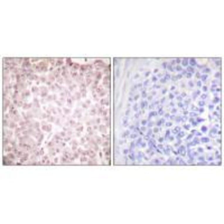 Immunohistochemistry - RCC1 Antibody from Signalway Antibody (33479) - Antibodies.com