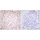 Immunohistochemistry - RCC1 Antibody from Signalway Antibody (33479) - Antibodies.com