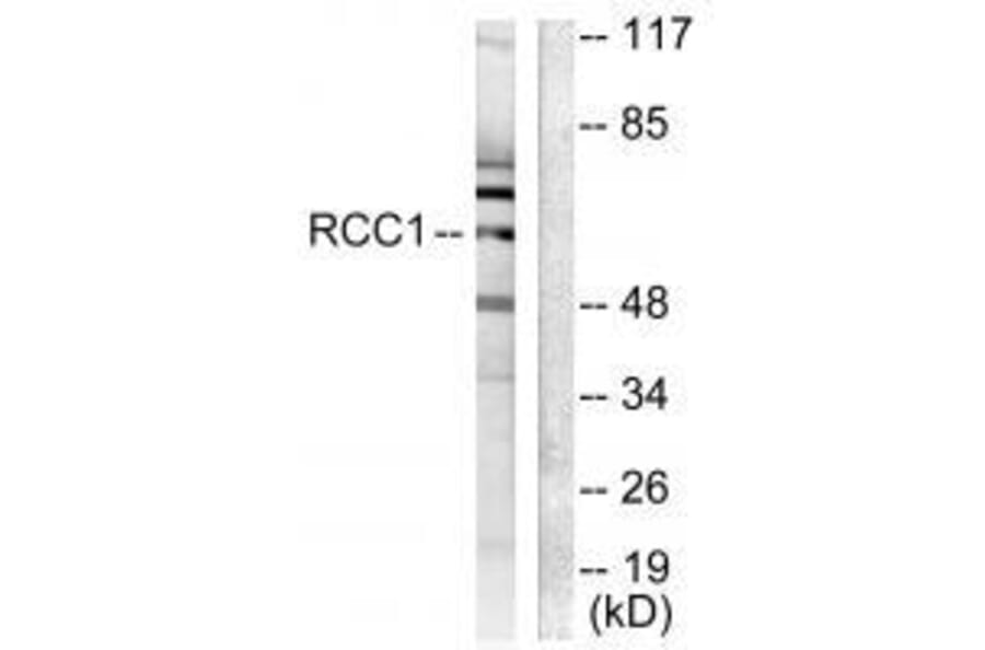 Western blot - RCC1 Antibody from Signalway Antibody (33479) - Antibodies.com