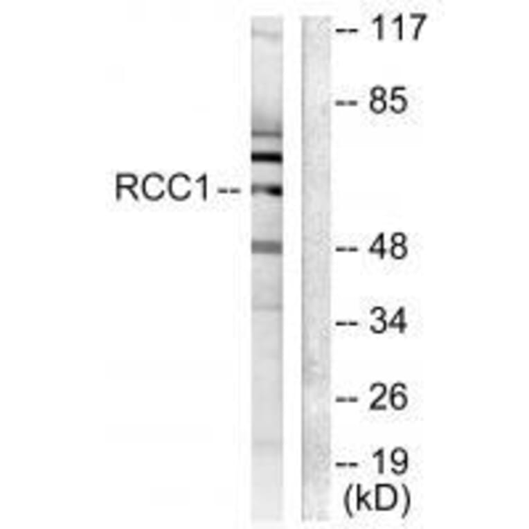 Western blot - RCC1 Antibody from Signalway Antibody (33479) - Antibodies.com
