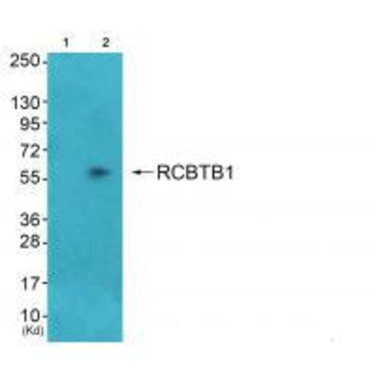 Western blot - RCC1 Antibody from Signalway Antibody (33479) - Antibodies.com
