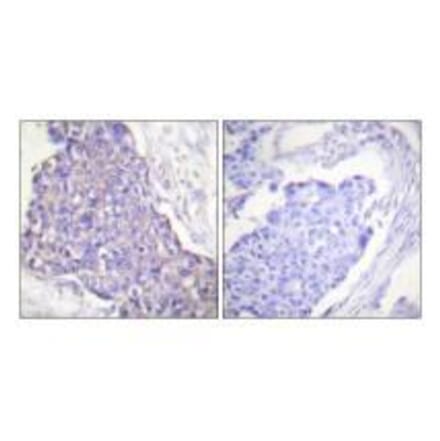 Immunohistochemistry - CD40 Antibody from Signalway Antibody (33507) - Antibodies.com