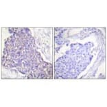 Immunohistochemistry - CD40 Antibody from Signalway Antibody (33507) - Antibodies.com