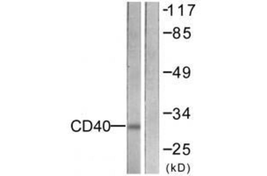 Western blot - CD40 Antibody from Signalway Antibody (33507) - Antibodies.com