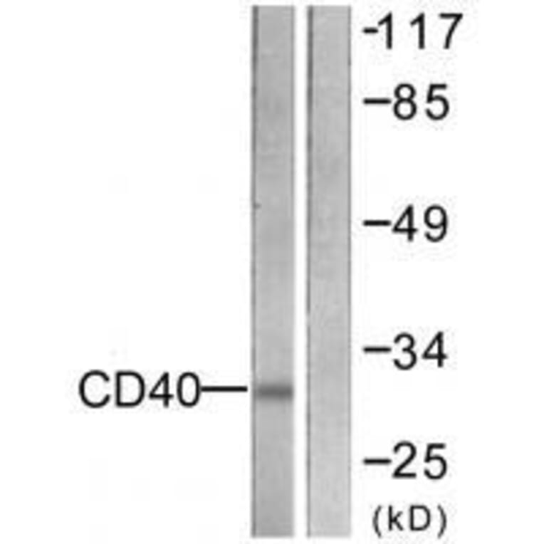 Western blot - CD40 Antibody from Signalway Antibody (33507) - Antibodies.com