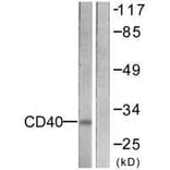 Western blot - CD40 Antibody from Signalway Antibody (33507) - Antibodies.com