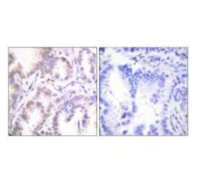 Immunohistochemistry - CDK7 Antibody from Signalway Antibody (33508) - Antibodies.com