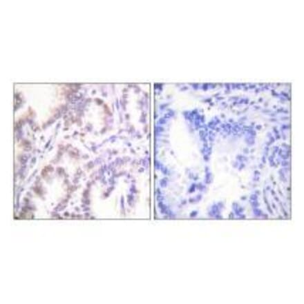 Immunohistochemistry - CDK7 Antibody from Signalway Antibody (33508) - Antibodies.com