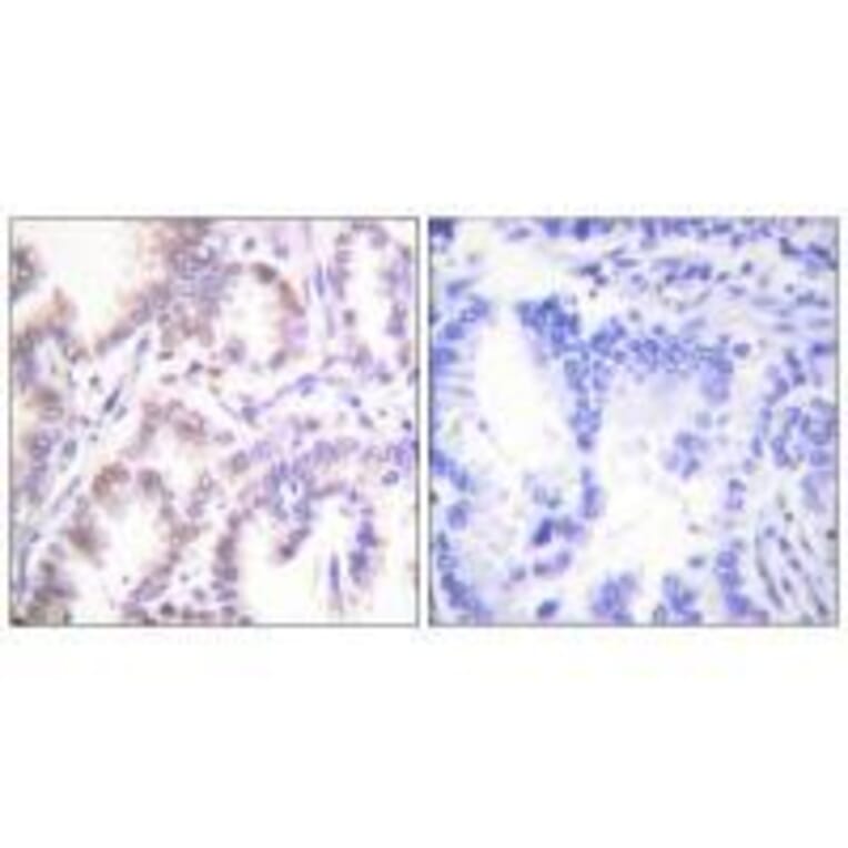 Immunohistochemistry - CDK7 Antibody from Signalway Antibody (33508) - Antibodies.com