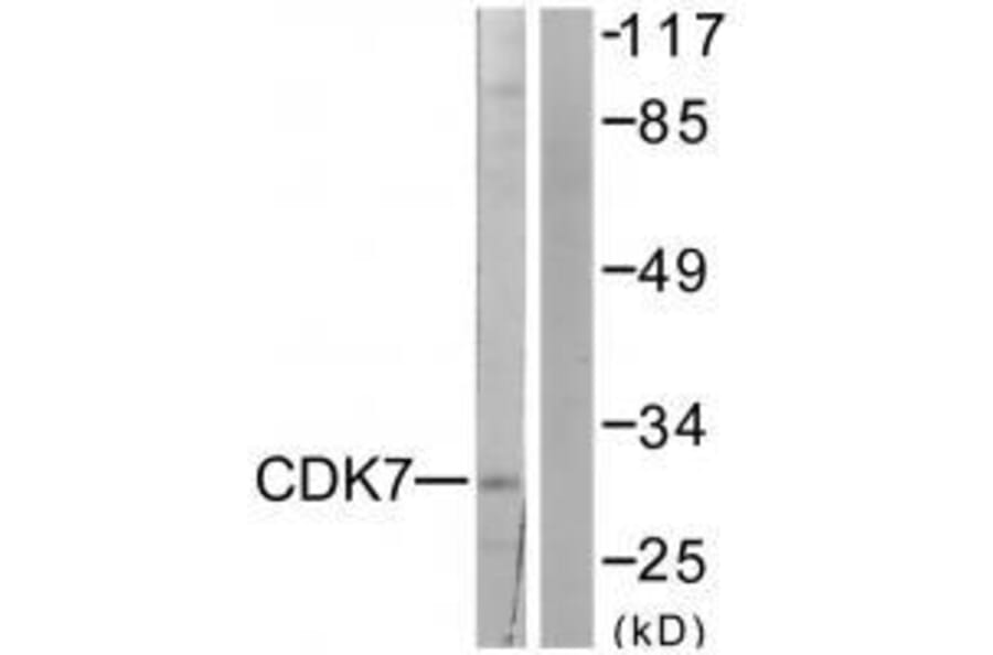 Western blot - CDK7 Antibody from Signalway Antibody (33508) - Antibodies.com