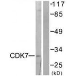 Western blot - CDK7 Antibody from Signalway Antibody (33508) - Antibodies.com