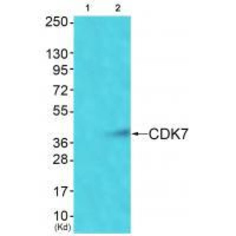 Western blot - CDK7 Antibody from Signalway Antibody (33508) - Antibodies.com