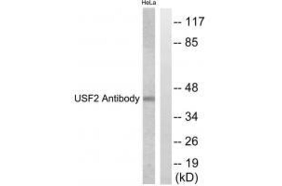 Western blot - USF2 Antibody from Signalway Antibody (33539) - Antibodies.com