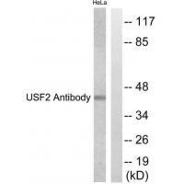 Western blot - USF2 Antibody from Signalway Antibody (33539) - Antibodies.com