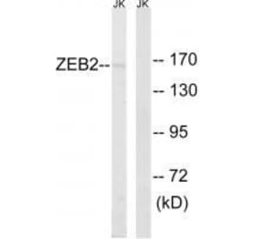 Western blot - ZEB2 Antibody from Signalway Antibody (33595) - Antibodies.com