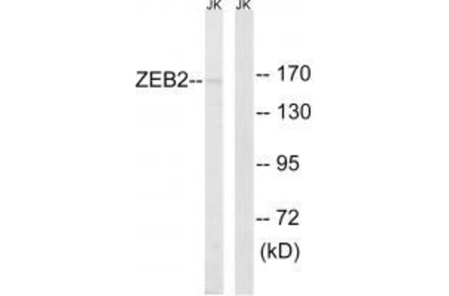 Western blot - ZEB2 Antibody from Signalway Antibody (33595) - Antibodies.com