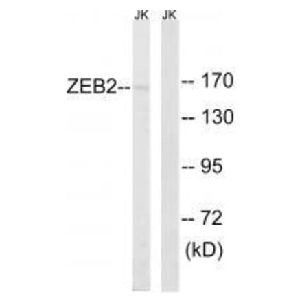 Western blot - ZEB2 Antibody from Signalway Antibody (33595) - Antibodies.com
