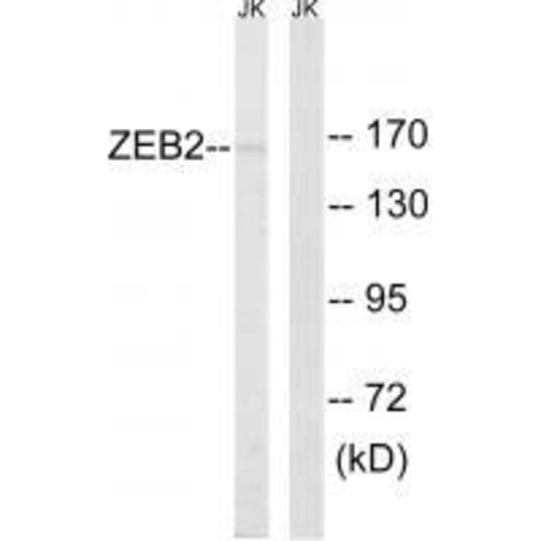 Western blot - ZEB2 Antibody from Signalway Antibody (33595) - Antibodies.com