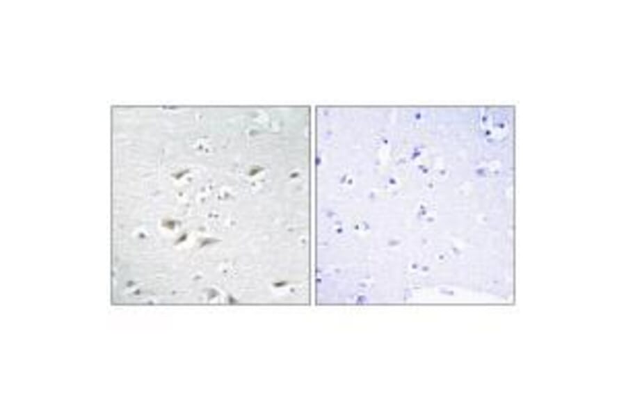 Immunohistochemistry - ZEB2 Antibody from Signalway Antibody (33595) - Antibodies.com