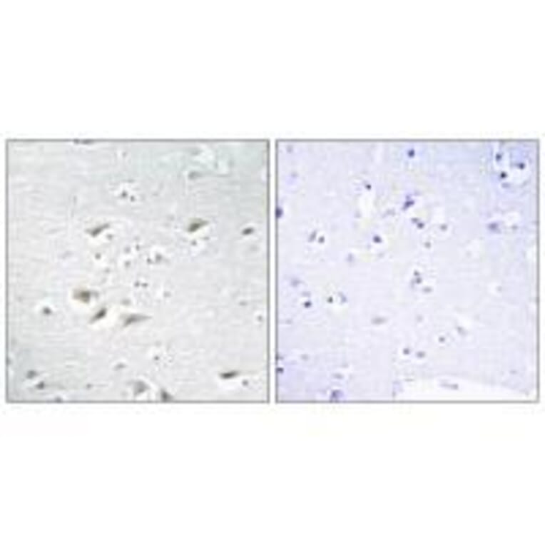 Immunohistochemistry - ZEB2 Antibody from Signalway Antibody (33595) - Antibodies.com