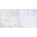 Immunohistochemistry - ZEB2 Antibody from Signalway Antibody (33595) - Antibodies.com