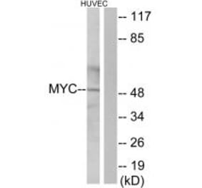 Western blot - Myc Antibody from Signalway Antibody (33647) - Antibodies.com