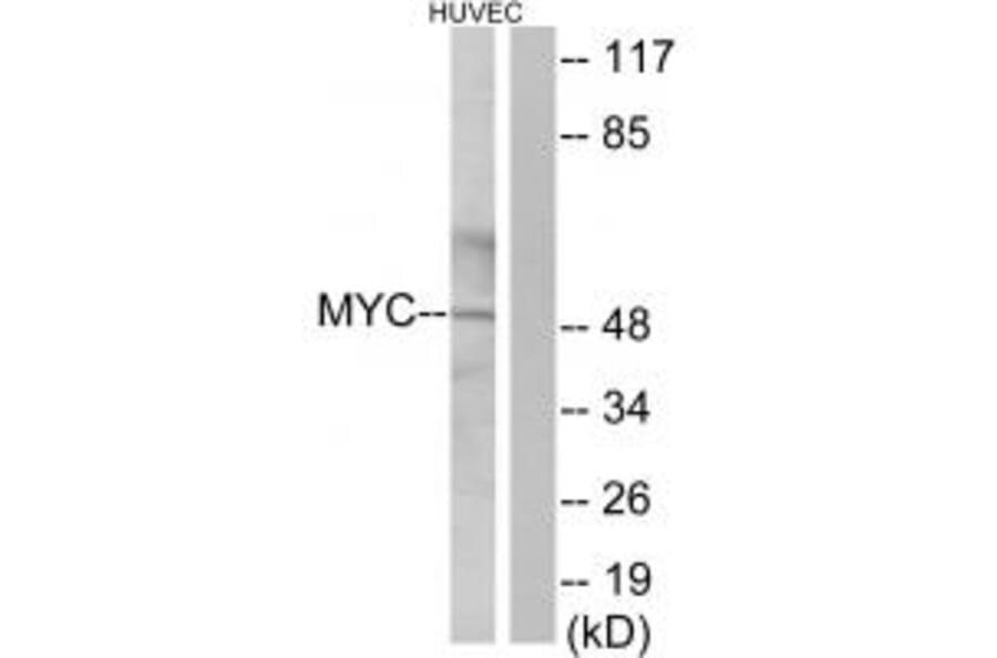 Western blot - Myc Antibody from Signalway Antibody (33647) - Antibodies.com