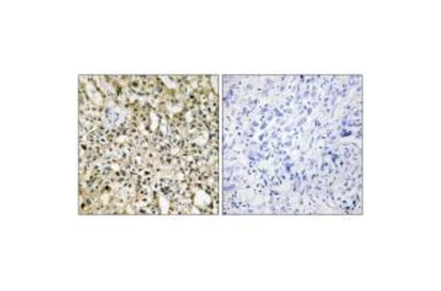 Immunohistochemistry - Myc Antibody from Signalway Antibody (33647) - Antibodies.com