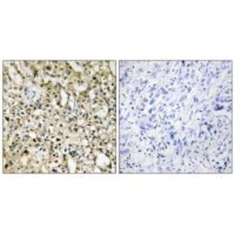 Immunohistochemistry - Myc Antibody from Signalway Antibody (33647) - Antibodies.com