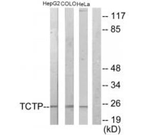 Western blot - TCTP Antibody from Signalway Antibody (33678) - Antibodies.com