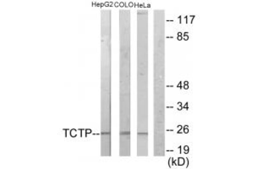 Western blot - TCTP Antibody from Signalway Antibody (33678) - Antibodies.com