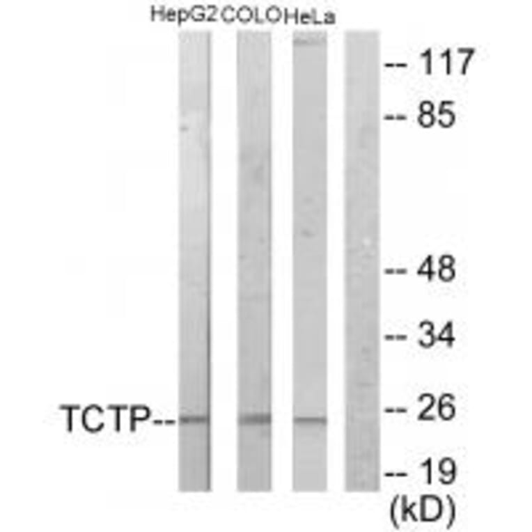 Western blot - TCTP Antibody from Signalway Antibody (33678) - Antibodies.com