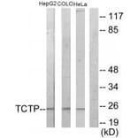 Western blot - TCTP Antibody from Signalway Antibody (33678) - Antibodies.com