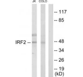 Western blot - IRF2 Antibody from Signalway Antibody (33680) - Antibodies.com