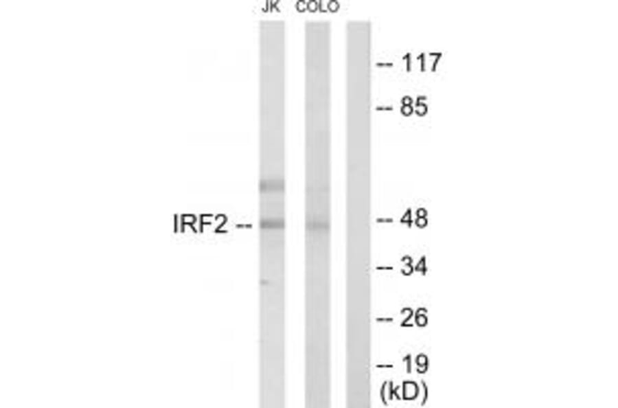 Western blot - IRF2 Antibody from Signalway Antibody (33680) - Antibodies.com