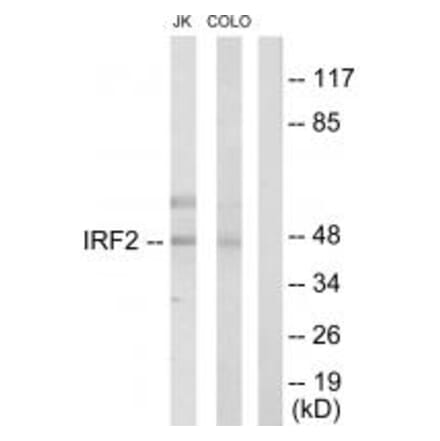 Western blot - IRF2 Antibody from Signalway Antibody (33680) - Antibodies.com